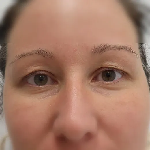 Image before