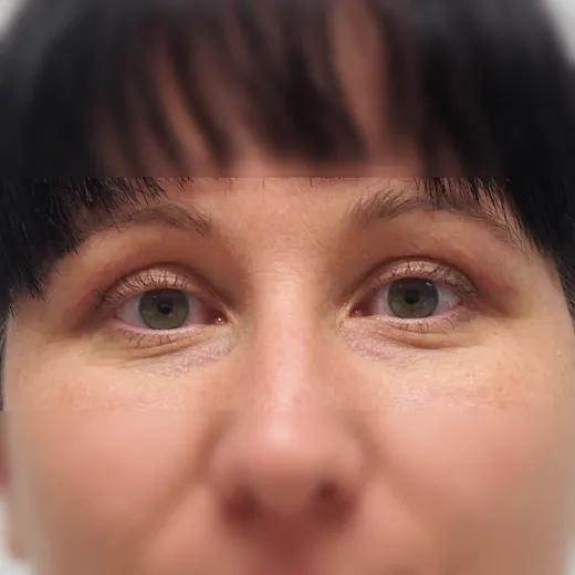 Image after