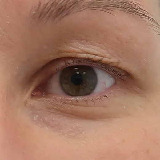 Image before