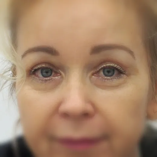 Image after
