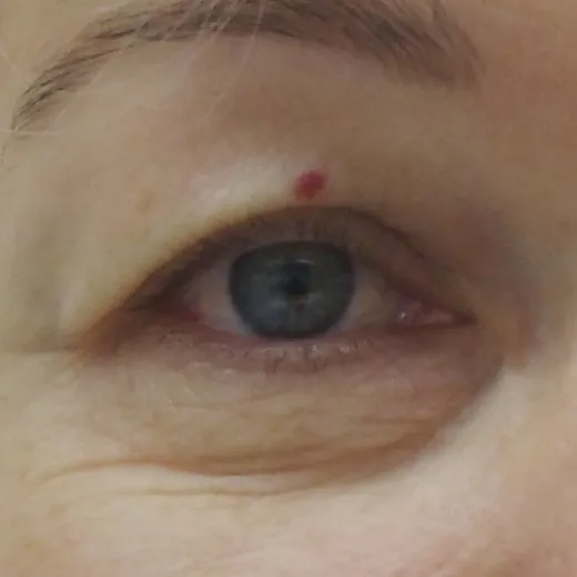 Image before