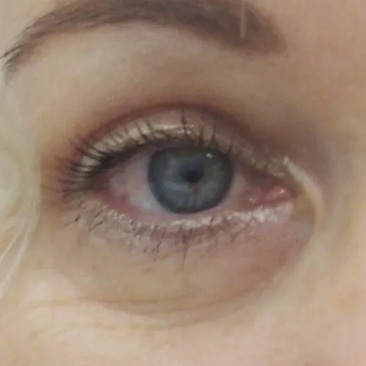 Image after