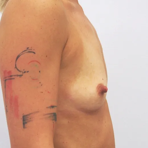 Image before