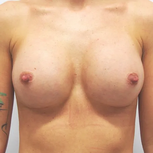 Image after