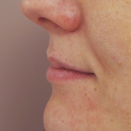 Image before