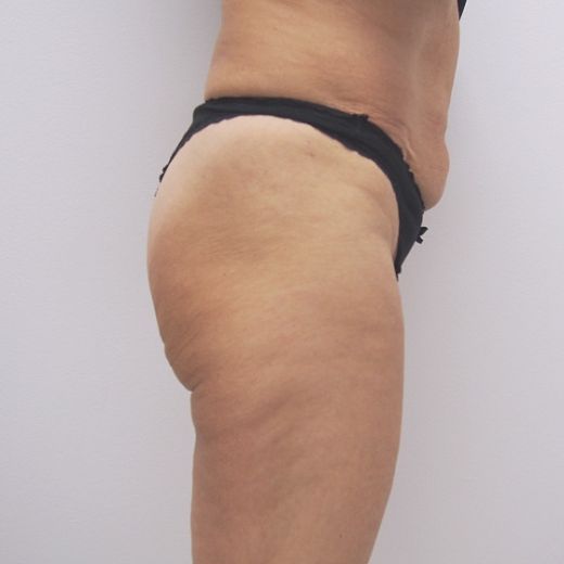 Image before