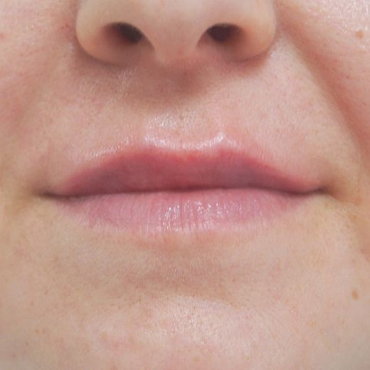 Image after