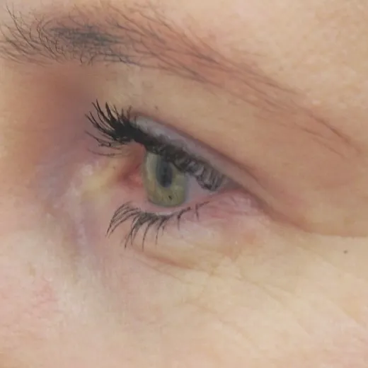 Image after