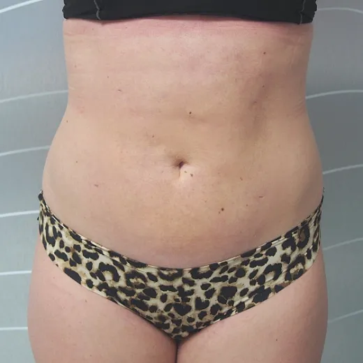 Image after