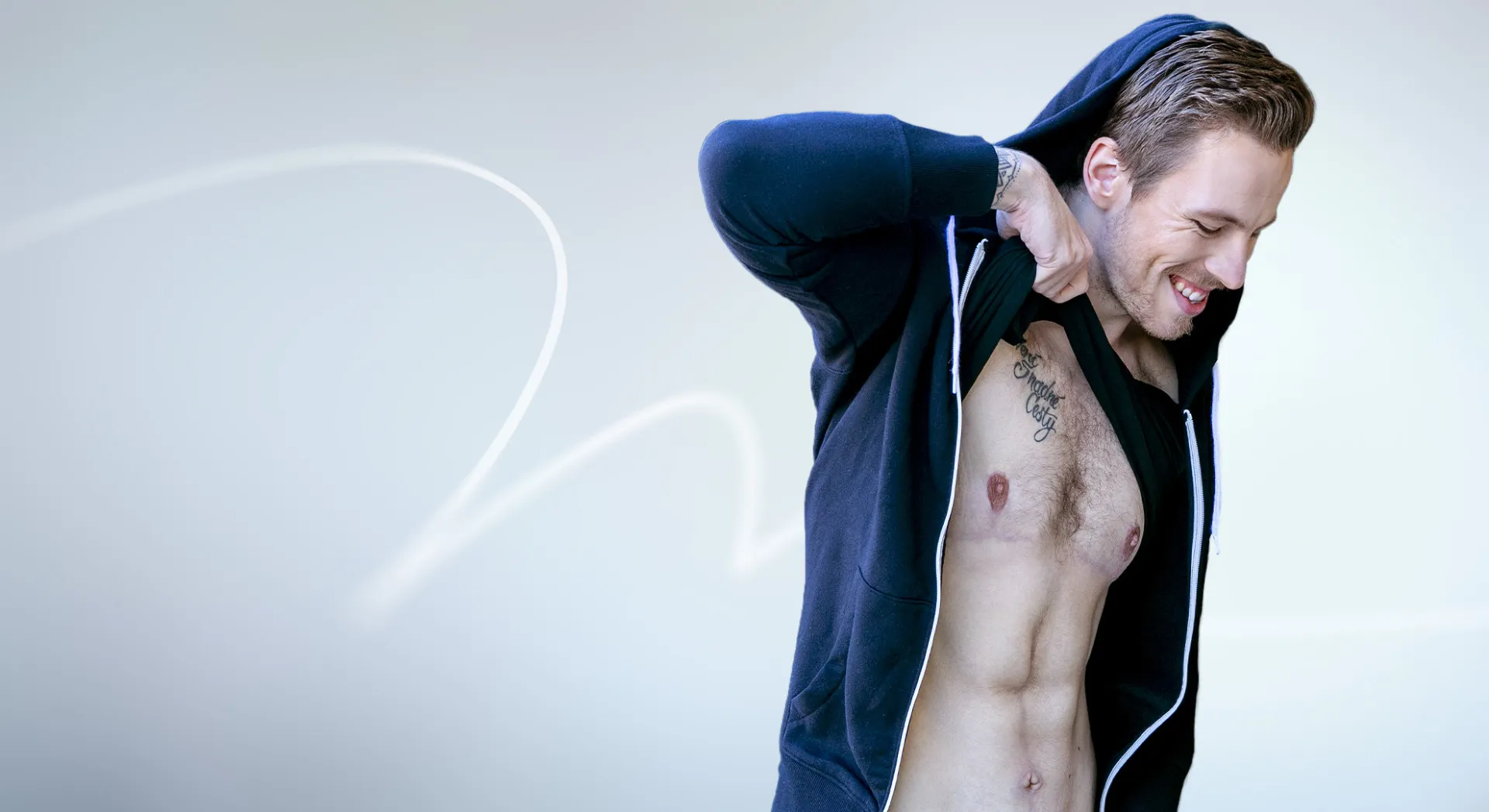 Herr David 27 - Bauchdeckenstraffung + Gynäkomastie