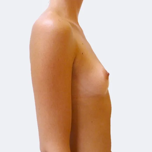 Image before
