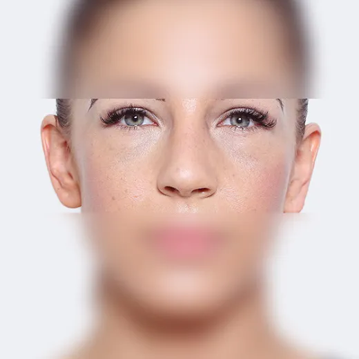 Image after