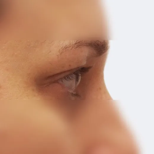Image before
