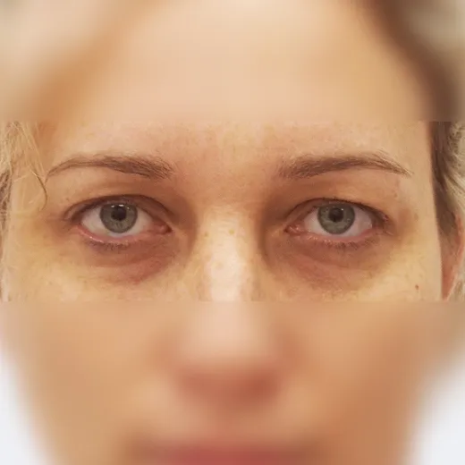 Image before