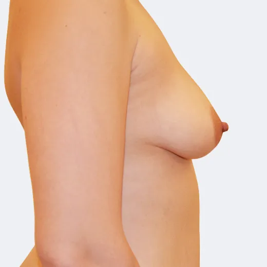 Image before