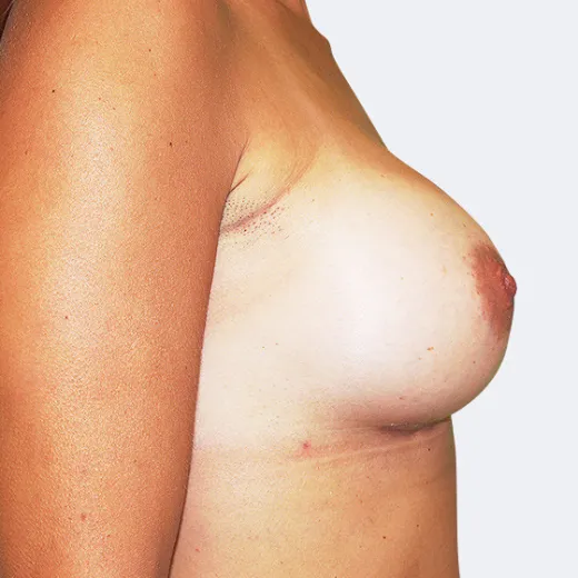 Image after