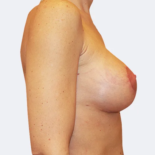 Image after