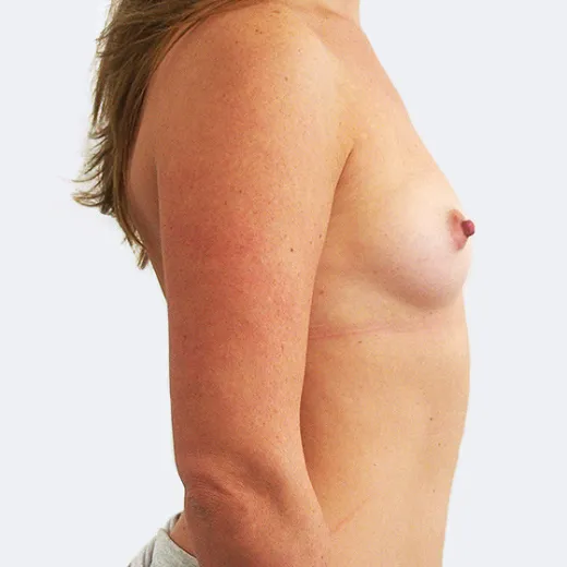 Image before