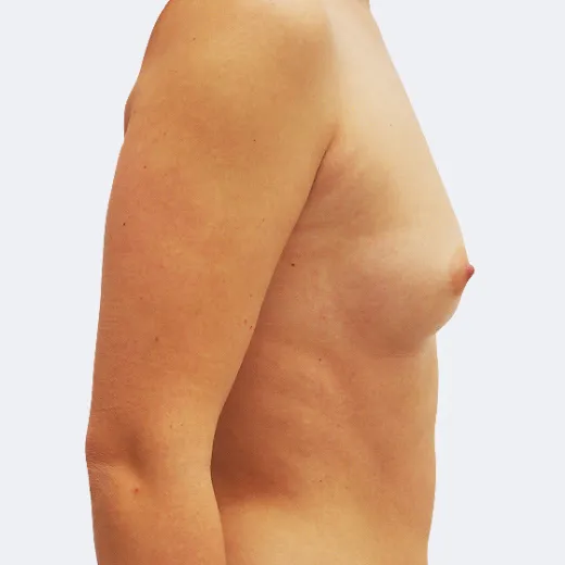 Image before