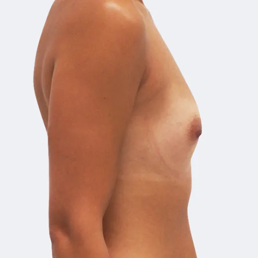 Image before