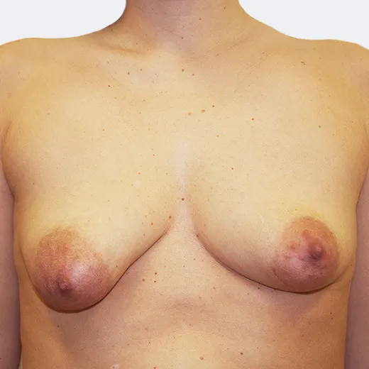 Image before