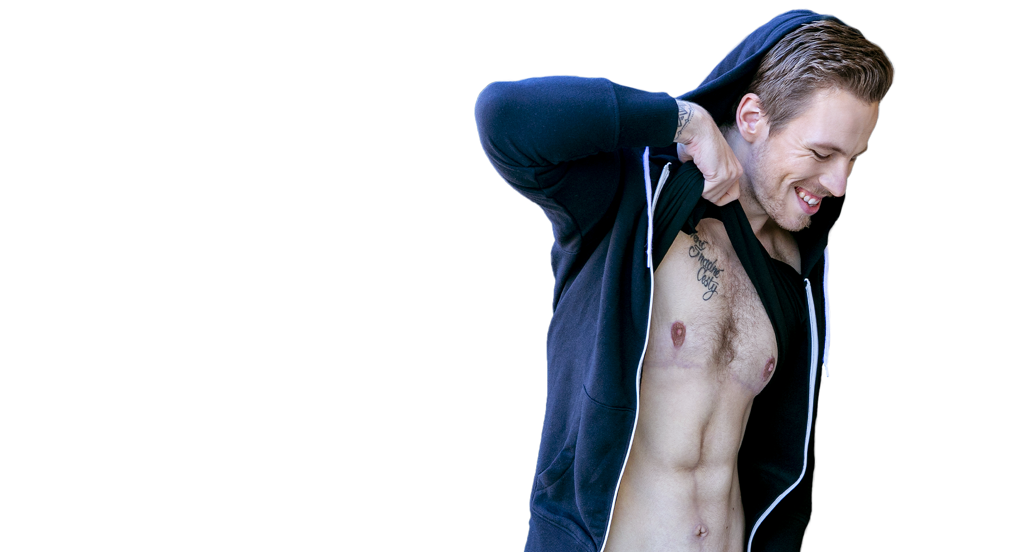 Herr David 27 - Bauchdeckenstraffung + Gynäkomastie